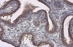 Invitrogen Nrf2 Polyclonal Antibody 100 &mu;L; Unconjugated:Antibodies,