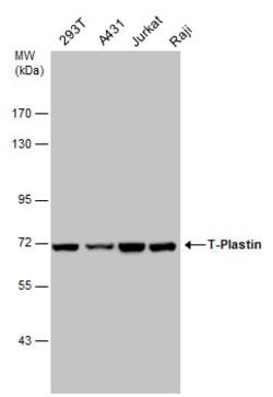 Invitrogen PLS3 Polyclonal Antibody 100 &mu;L | Buy Online | Invitrogen&trade; | Fisher Scientific