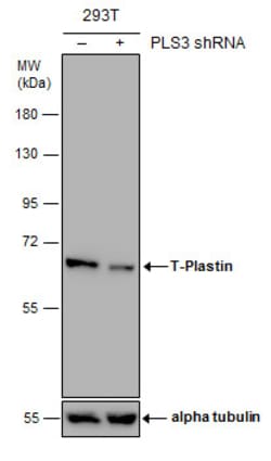 Invitrogen PLS3 Polyclonal Antibody 100 &mu;L | Buy Online | Invitrogen&trade; | Fisher Scientific