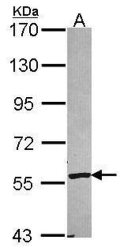 Invitrogen CYP2A6 Polyclonal Antibody 100 μL; Unconjugated:Antibodies,