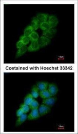 Invitrogen DARS Polyclonal Antibody 100 &mu;L; Unconjugated:Antibodies,