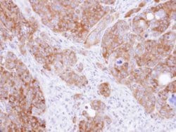 Invitrogen DARS Polyclonal Antibody 100 &mu;L; Unconjugated:Antibodies,