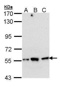 Invitrogen DARS Polyclonal Antibody 100 &mu;L; Unconjugated:Antibodies,