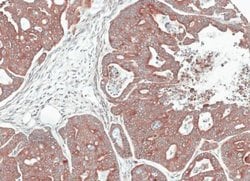 Invitrogen NOV Polyclonal Antibody 100 &mu;L; Unconjugated:Antibodies,