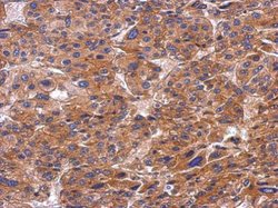 Invitrogen SNX9 Polyclonal Antibody 100 &mu;L | Buy Online | Invitrogen&trade; | Fisher Scientific