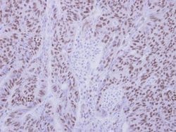 Invitrogen ZMYND11 Polyclonal Antibody 100 &mu;L; Unconjugated:Antibodies,