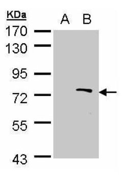 Invitrogen ZMYND11 Polyclonal Antibody 100 &mu;L; Unconjugated:Antibodies,
