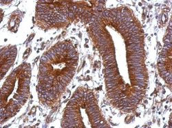 Invitrogen Vitronectin Polyclonal Antibody 100 &mu;L; Unconjugated:Antibodies,