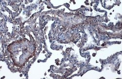 Invitrogen Vitronectin Polyclonal Antibody 100 &mu;L; Unconjugated:Antibodies,