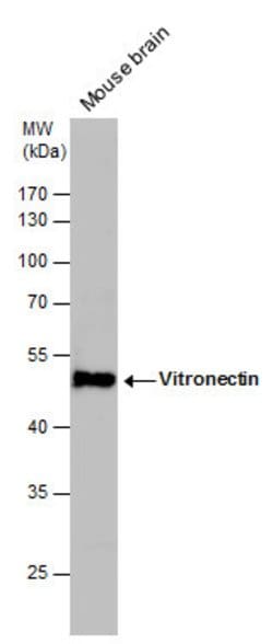 Invitrogen Vitronectin Polyclonal Antibody 100 &mu;L; Unconjugated:Antibodies,