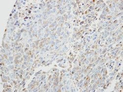 Invitrogen PRKX Polyclonal Antibody 100 &mu;L; Unconjugated:Antibodies,