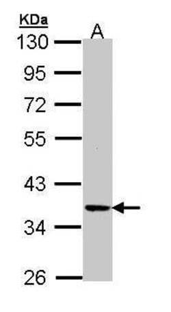 Invitrogen PRKX Polyclonal Antibody 100 &mu;L; Unconjugated:Antibodies,