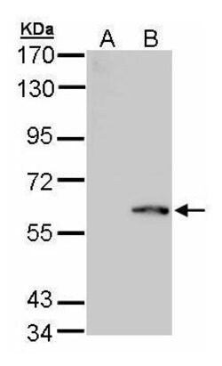 Invitrogen FPGS Polyclonal Antibody 100 &mu;L; Unconjugated:Antibodies,