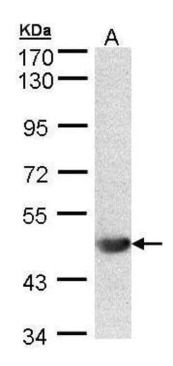Invitrogen ALG1 Polyclonal Antibody 100 &mu;L | Buy Online | Invitrogen&trade; | Fisher Scientific