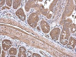 Invitrogen ECH1 Polyclonal Antibody 100 &mu;L; Unconjugated:Antibodies,