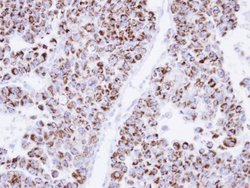 Invitrogen ECH1 Polyclonal Antibody 100 &mu;L; Unconjugated:Antibodies,