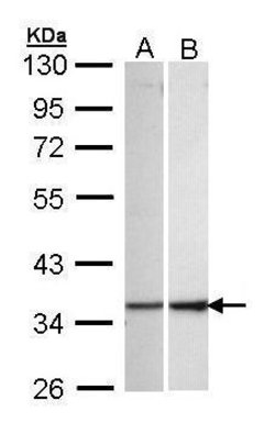 Invitrogen ECH1 Polyclonal Antibody 100 &mu;L; Unconjugated:Antibodies,