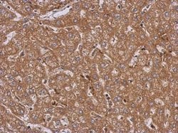 LRRN2 Polyclonal Antibody, Invitrogen 100 &mu;L; Unconjugated:Antibodies,