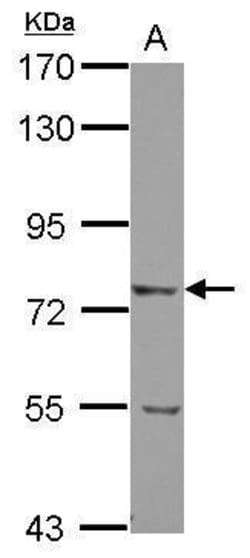 LRRN2 Polyclonal Antibody, Invitrogen 100 &mu;L; Unconjugated:Antibodies,