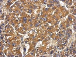Invitrogen Complement Factor B Polyclonal Antibody 100 &mu;L; Unconjugated:Antibodies,