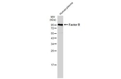 Invitrogen Complement Factor B Polyclonal Antibody 100 &mu;L; Unconjugated:Antibodies,