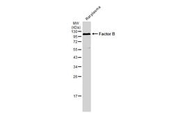Invitrogen Complement Factor B Polyclonal Antibody 100 &mu;L; Unconjugated:Antibodies,
