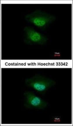 Invitrogen NAB2 Polyclonal Antibody 100 &mu;L; Unconjugated:Antibodies,