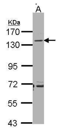 Invitrogen CD22 Polyclonal Antibody 100 &mu;L | Buy Online | Invitrogen&trade; | Fisher Scientific