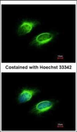 Invitrogen PAPSS1 Polyclonal Antibody 100 &mu;L; Unconjugated:Antibodies,