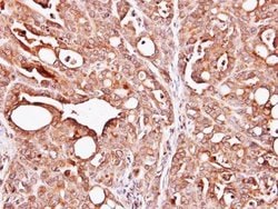 Invitrogen PAPSS1 Polyclonal Antibody 100 &mu;L; Unconjugated:Antibodies,