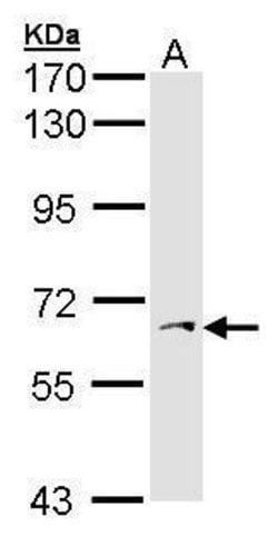 Invitrogen PAPSS1 Polyclonal Antibody 100 &mu;L; Unconjugated:Antibodies,