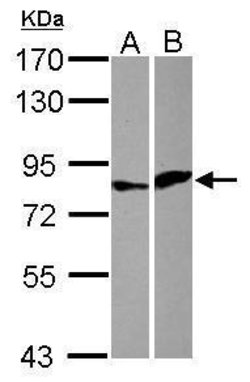 ELF4 Polyclonal Antibody, Invitrogen 100 &mu;L | Buy Online | Invitrogen | Fisher Scientific