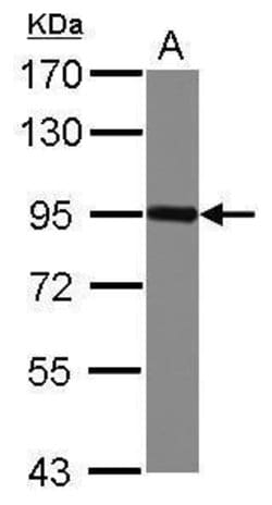Invitrogen Nectin 3 Polyclonal Antibody 100 &mu;L | Buy Online | Invitrogen&trade; | Fisher Scientific