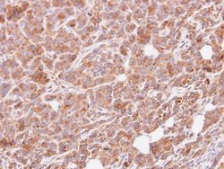 GNAI3 Polyclonal Antibody, Invitrogen 100 &mu;L; Unconjugated:Antibodies,
