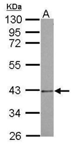 PSMD7 Polyclonal Antibody, Invitrogen 100 μL; Unconjugated:Antibodies,