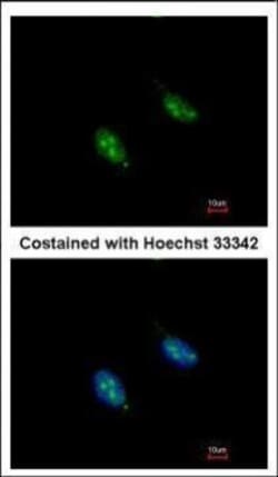 Invitrogen RFC3 Polyclonal Antibody 100 &mu;L; Unconjugated:Antibodies,