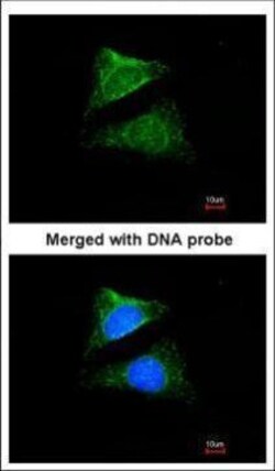 Invitrogen DHCR24 Polyclonal Antibody 100 &mu;L; Unconjugated:Antibodies,