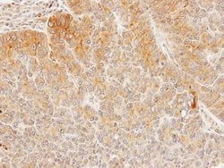 Invitrogen DHCR24 Polyclonal Antibody 100 &mu;L; Unconjugated:Antibodies,