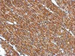 Invitrogen CYP27A1 Polyclonal Antibody 100 μL; Unconjugated:Antibodies,