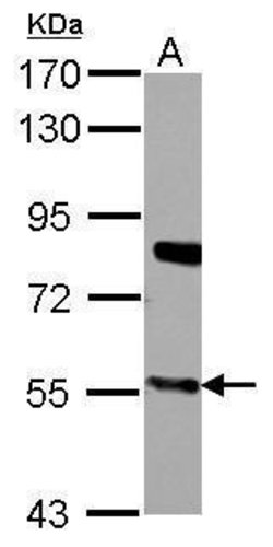 Invitrogen CYP27A1 Polyclonal Antibody 100 μL; Unconjugated:Antibodies,