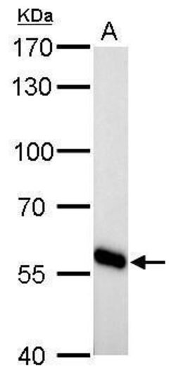Invitrogen CYP27A1 Polyclonal Antibody 100 μL; Unconjugated:Antibodies,