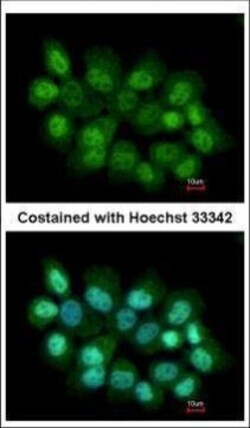 Invitrogen PRMT2 Polyclonal Antibody 100 &mu;L; Unconjugated:Antibodies,