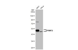 Invitrogen PRMT2 Polyclonal Antibody 100 &mu;L; Unconjugated:Antibodies,
