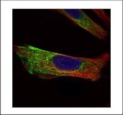 Invitrogen Cytokeratin 17 Polyclonal Antibody 100 &mu;L; Unconjugated:Antibodies,