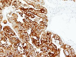 Invitrogen Cytokeratin 17 Polyclonal Antibody 100 &mu;L; Unconjugated:Antibodies,