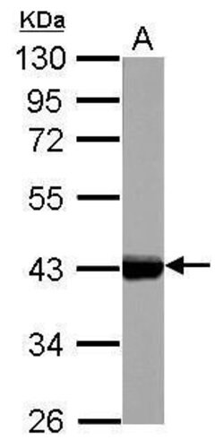 Invitrogen Cytokeratin 17 Polyclonal Antibody 100 &mu;L; Unconjugated:Antibodies,