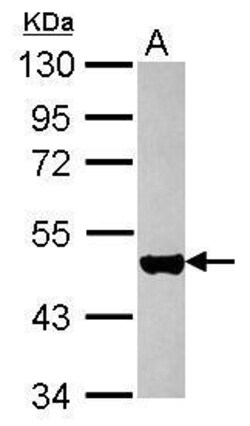 Invitrogen Cytokeratin 17 Polyclonal Antibody 100 &mu;L; Unconjugated:Antibodies,