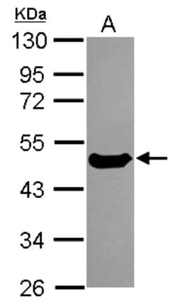 Invitrogen Cytokeratin 17 Polyclonal Antibody 100 &mu;L; Unconjugated:Antibodies,