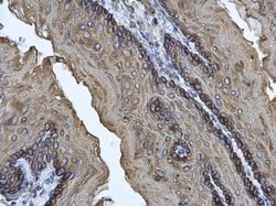 Invitrogen Cytokeratin 17 Polyclonal Antibody 100 &mu;L; Unconjugated:Antibodies,
