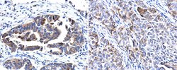Invitrogen Cytokeratin 17 Polyclonal Antibody 100 &mu;L; Unconjugated:Antibodies,